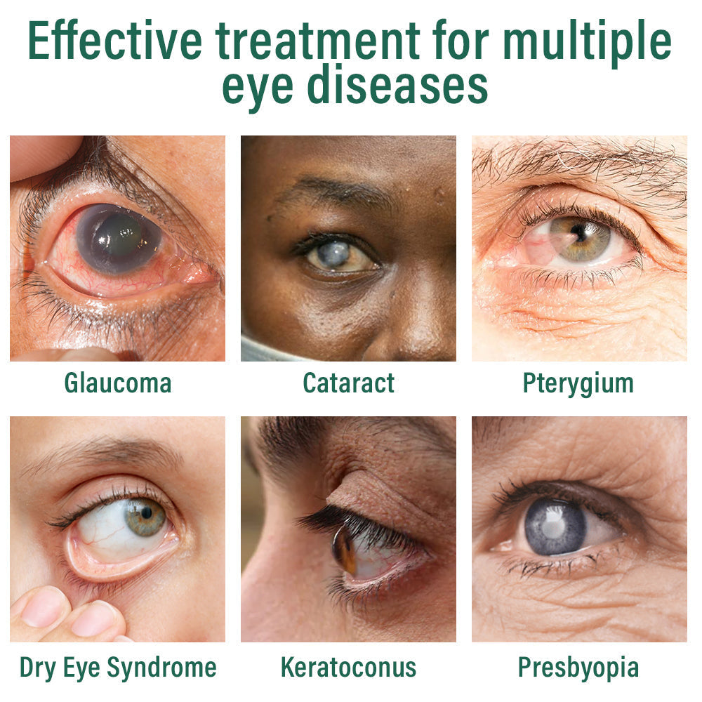 👩‍⚕️ODALIT™ Nano Eye Drops Serum ✅FDA Approved(Suitable for presbyopia, dry eye syndrome, glaucoma, and cataracts) ☘️☘️