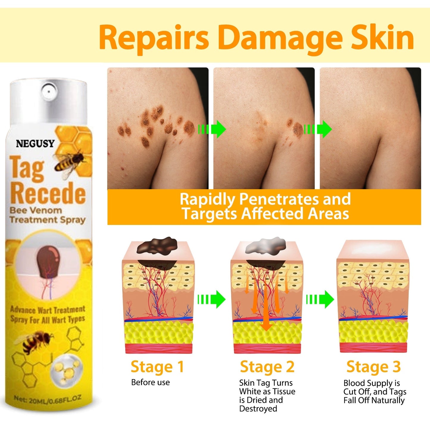 🐝NEGUSY™ TagRecede Bee Venom Treatment Spray