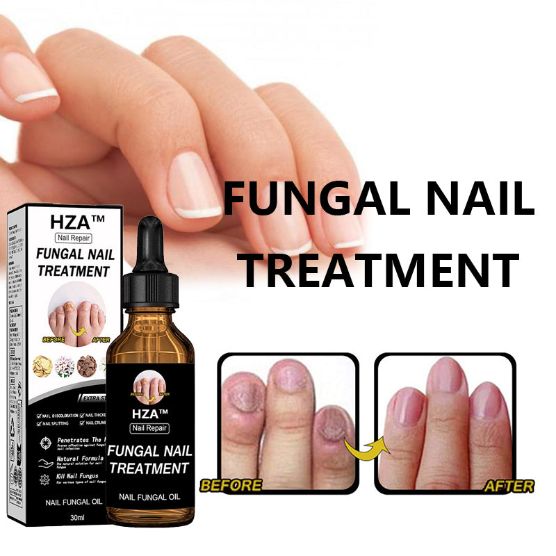 Final 5 Hours: 60% OFF🔥HZA™Fungal Nail Treatment