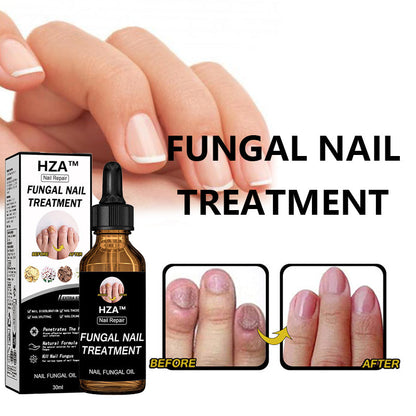 Final 5 Hours: 60% OFF🔥HZA™Fungal Nail Treatment