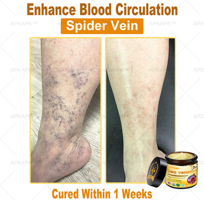 Skin Tags, Eczema, or Psoriasis? This 15-Minute Bee Venom Cream Soothes, Heals & Clears Fast—No Steroids, No Scars