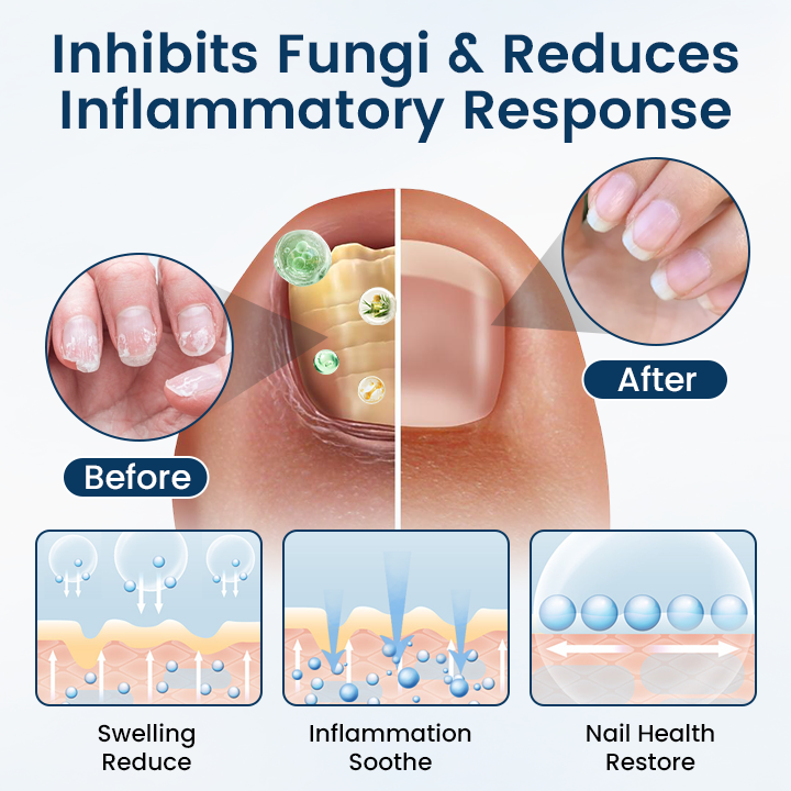 Fivfivgo® OnyxiGuard PRO Fungal Repair Herbal Spray