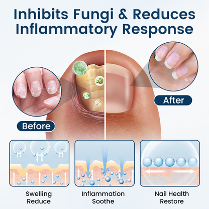 Fivfivgo® OnyxiGuard PRO Fungal Repair Herbal Spray