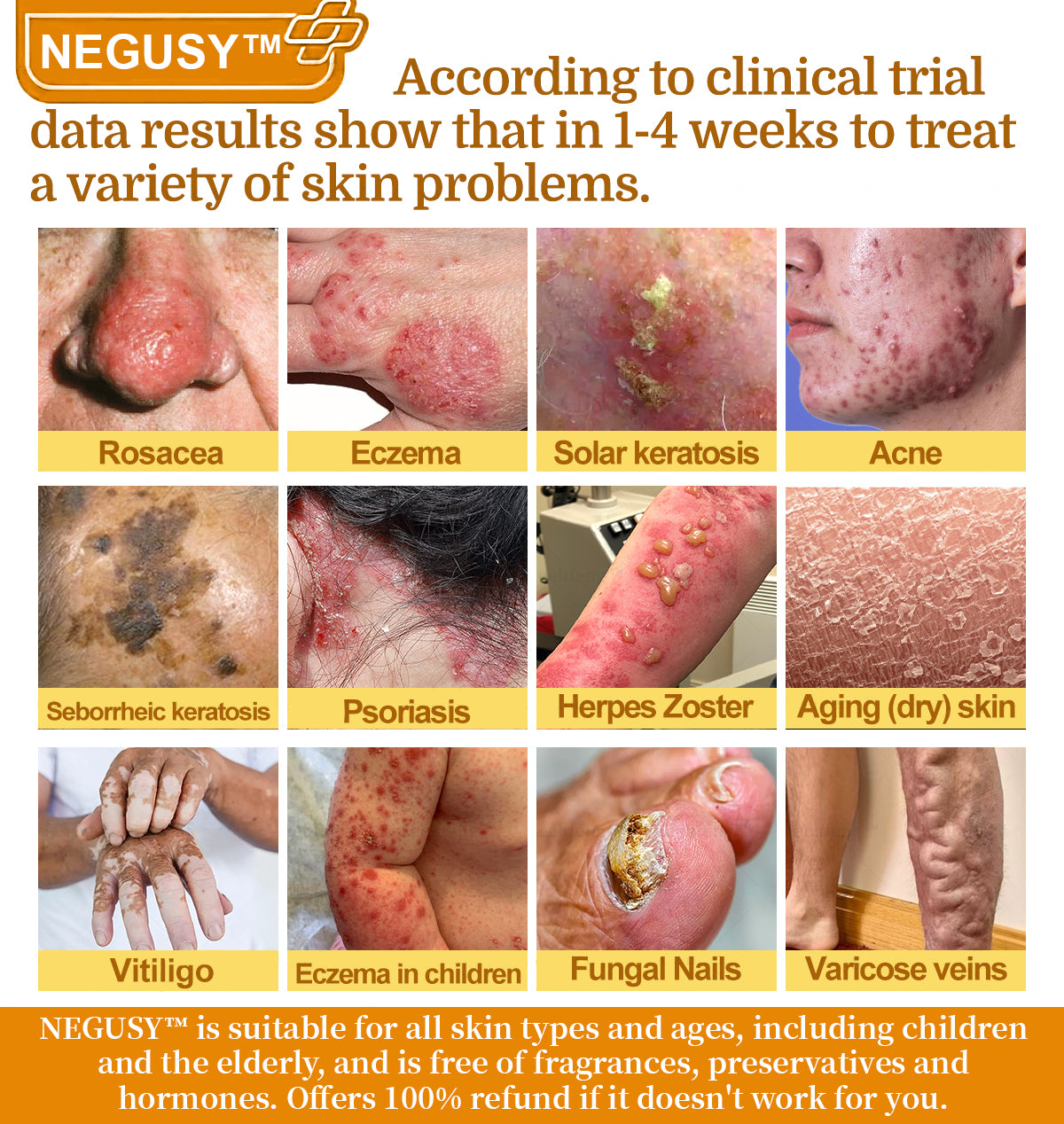 NEGUSY™ 7-Day Intensive Skin Repair Cream | FDA Certified & Doctor Recommended 🌟👩‍⚕️