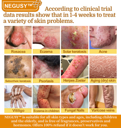NEGUSY™ 7-Day Intensive Skin Repair Cream | FDA Certified & Doctor Recommended 🌟👩‍⚕️