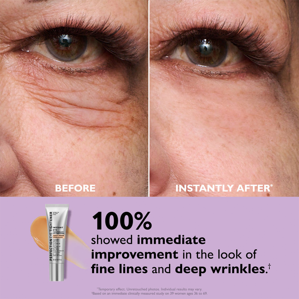 🌸Final Day: 70% OFF🌸 Instant Eye Tightener – Lift, Smooth & Look 10 Years Younger Instantly ✨