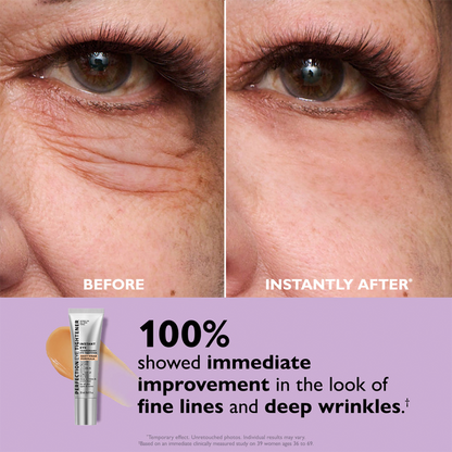 🌸Final Day: 70% OFF🌸 Instant Eye Tightener – Lift, Smooth & Look 10 Years Younger Instantly ✨
