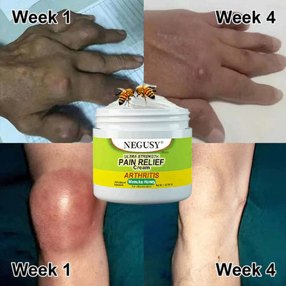 🐝NEGUSY®New Zealand Bee Venom Joint and Bone Therapy Advanced Cream⏳Limited time discount of 80%⏳