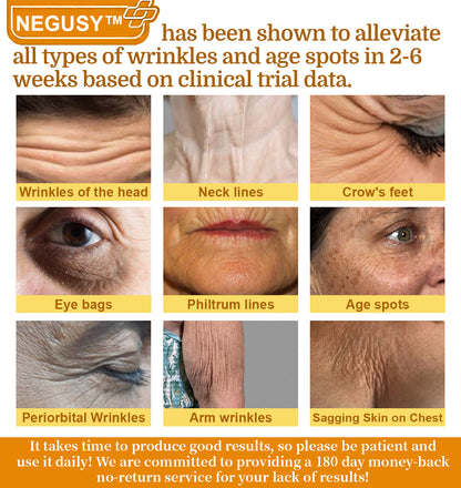 NEGUSY™ 7-Day Intensive Skin Repair Cream | FDA Certified & Doctor Recommended 🌟👩‍⚕️