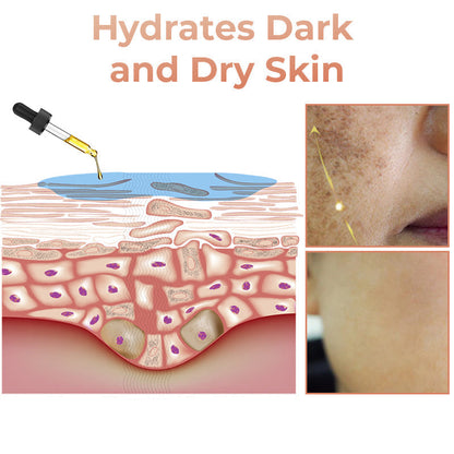 ✨Seurico™ Rapid Dark Spot Eraser – Melanin Correcting Facial Serum🔥