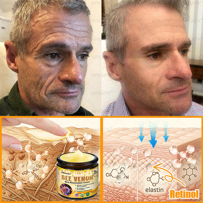 ODALIT™ | Eliminates wrinkles and firms sagging skin in 7 days.