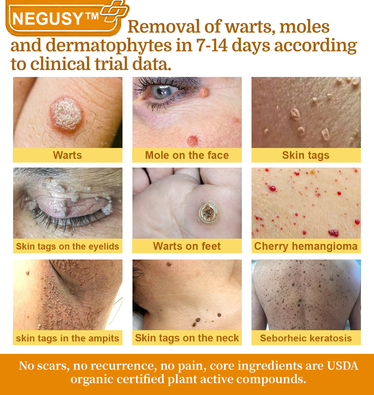 NEGUSY™ 7-Day Intensive Skin Repair Cream | FDA Certified & Doctor Recommended 🌟👩‍⚕️