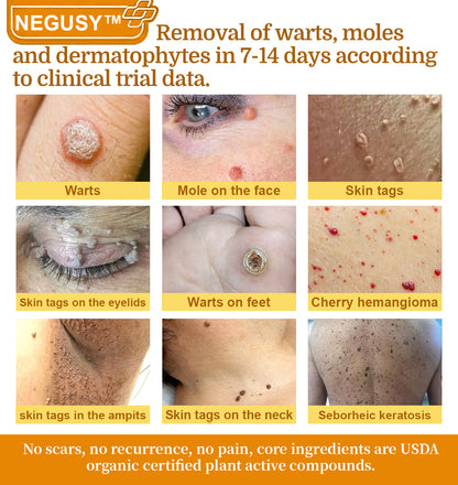 NEGUSY™ 7-Day Intensive Skin Repair Cream | FDA Certified & Doctor Recommended 🌟👩‍⚕️