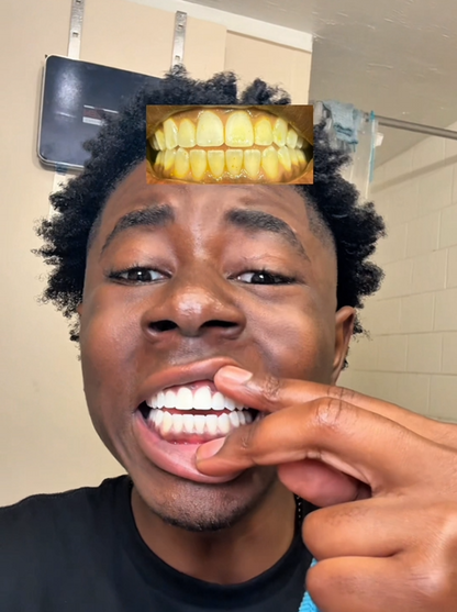 SmileSavvy® Teeth Whitening Powder
