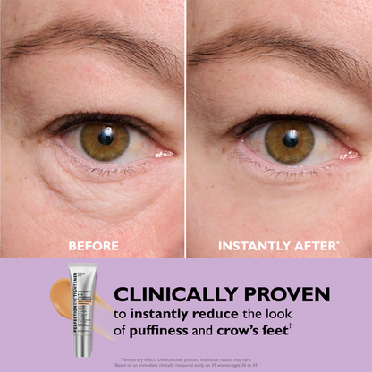 🌸Final Day: 70% OFF🌸 Instant Eye Tightener – Lift, Smooth & Look 10 Years Younger Instantly ✨