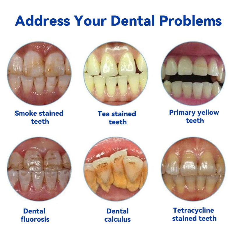 Oraliz™ Repair Teeth Anti-Decay - Hydroxyapatite Toothpastea