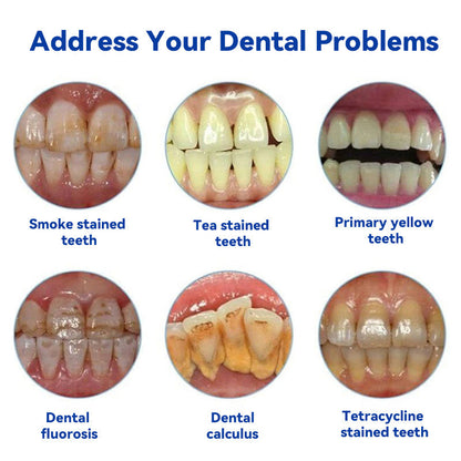 Oraliz™ Repair Teeth Anti-Decay - Hydroxyapatite Toothpastea