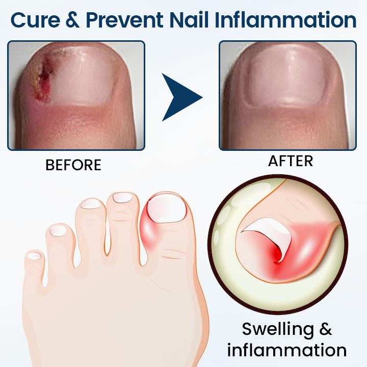 Fivfivgo® OnyxiGuard PRO Fungal Repair Herbal Spray