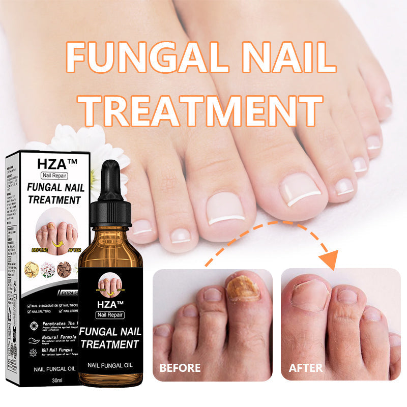 Final 5 Hours: 60% OFF🔥HZA™Fungal Nail Treatment