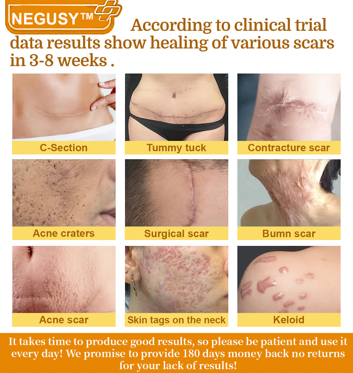 NEGUSY™ 7-Day Intensive Skin Repair Cream | FDA Certified & Doctor Recommended 🌟👩‍⚕️