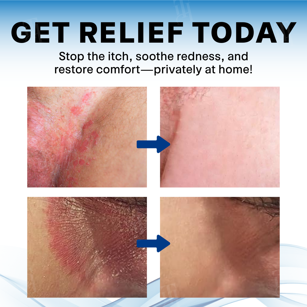 Fivfivgo® Scrotum Itchy Treatment Cream PRO