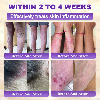 Made and Shipped from USA ✨Evolvion® Biotin 10-in-1 Skin Restoration Cream 🍀