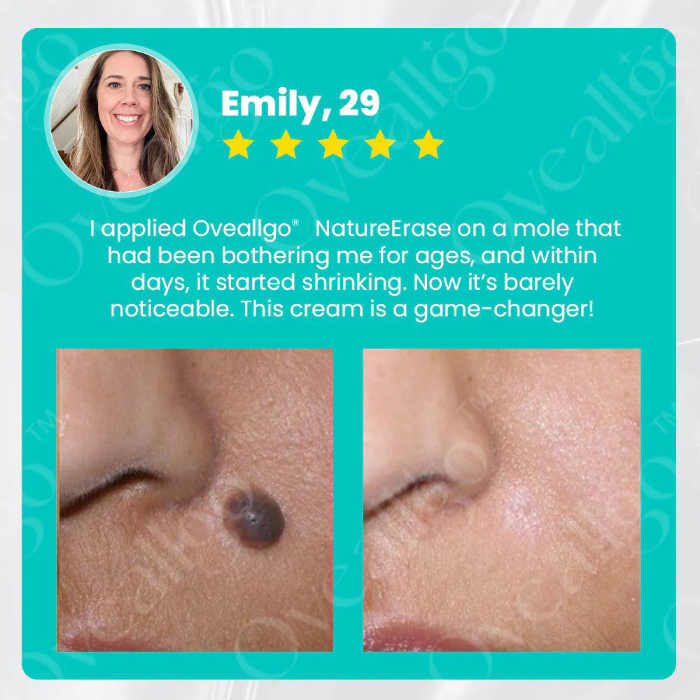 ✅ Official Store: Oveallgo® NatureErase Instant Alligator Oil Mole & Spot Removal Plus Gel
