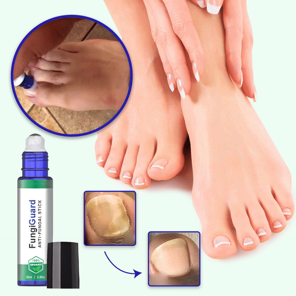 FungiGuard™ Anti-Fungal Stick | Kills Even The Most Stubborn Nail Fungus On Contact!