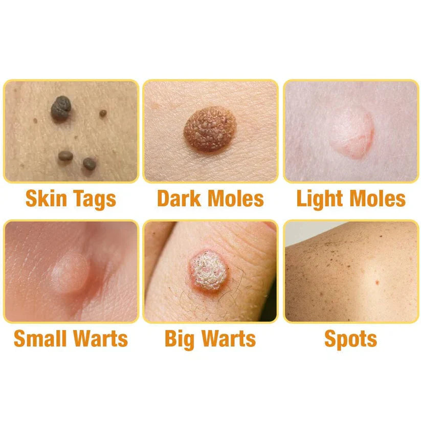 🐝LOVILDS™ TagRecede Bee Venom Treatment Spray