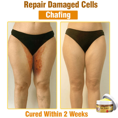 🐝 flysmus® Bee Venom Comprehensive Cream