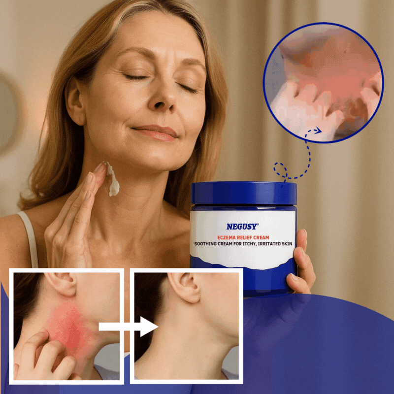 Barrier Renewal Remedy: ODALIT™ Eczema Relief Cream Stops Itchy, Red Flare-ups and Restores Clear, Healthy Skin in Just 30 Days