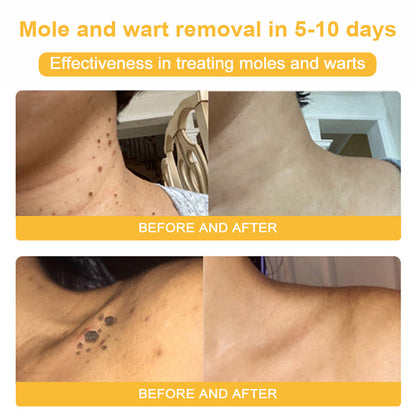 NESLEMY™ Bee Venom Skin Cream（👨‍⚕AAD Recommended),for Remove Warts, Acne and Scars