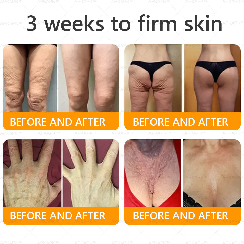 ODALIT™ | Eliminates wrinkles and firms sagging skin in 7 days.