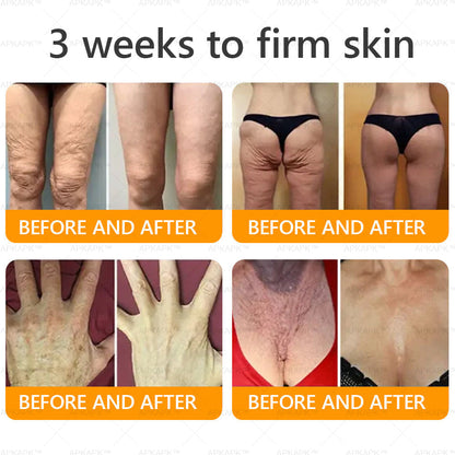 ODALIT™ | Eliminates wrinkles and firms sagging skin in 7 days.