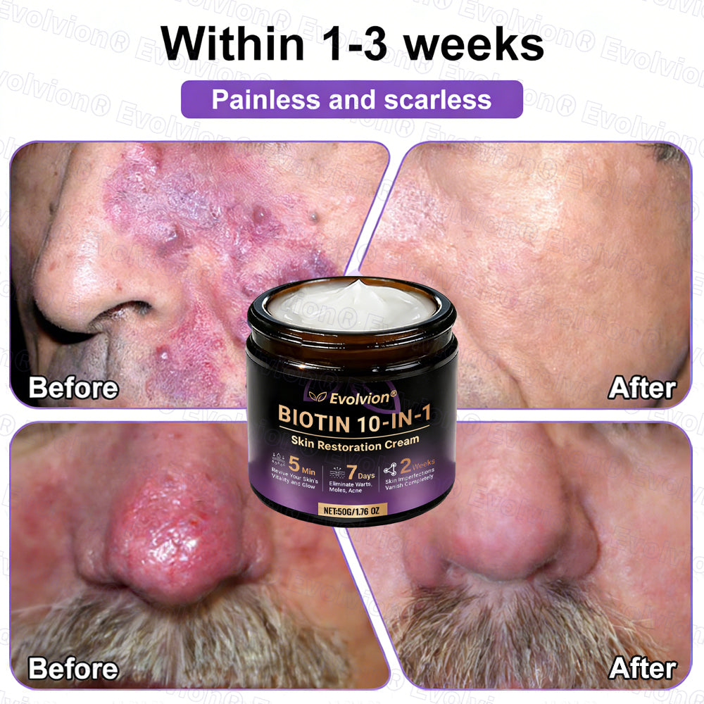 Made and Shipped from USA ✨Evolvion® Biotin 10-in-1 Skin Restoration Cream 🍀