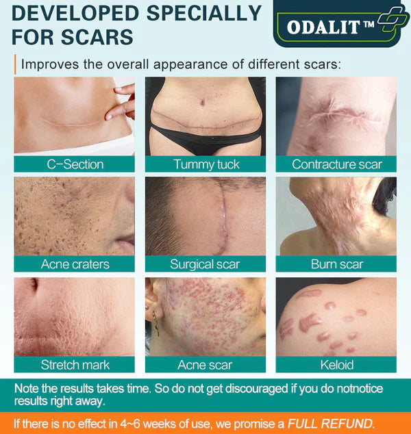 ❤️Advanced Scar Spray For All Types of Scars - For example Acne Scars, Surgical Scars and Stretch Marks ⚡️⚡️⚡️