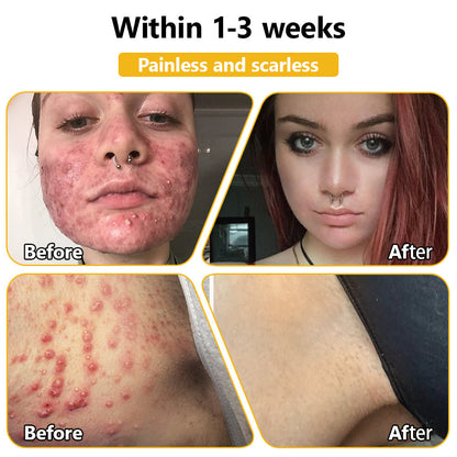 NEGUSY™ Bee Venom Skin Treatment Cream (AAD Recommended)