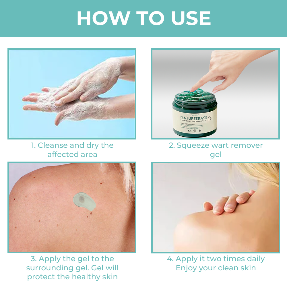 ✅ Official Store: Oveallgo® NatureErase Instant Alligator Oil Mole & Spot Removal Plus Gel