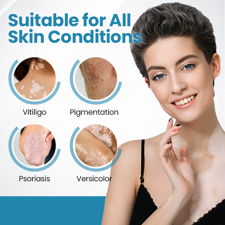 Bikenda® Evena Advanced Vitiligo Therapy Device