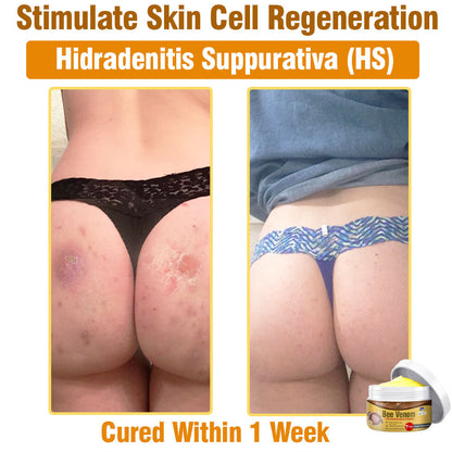 🐝 flysmus® Bee Venom Comprehensive Cream