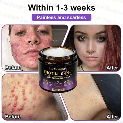 Made and Shipped from USA ✨Evolvion® Biotin 10-in-1 Skin Restoration Cream 🍀