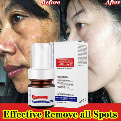 ✨FLASH SALE：⚡5-second brightening rescue: Dark spots disappear, blemishes fade, and skin becomes radiant! Vitamin C Whitening Freckles ESSENCE