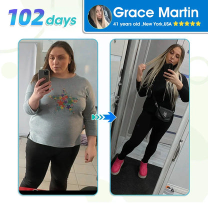 🔥Final 3 Hours: 80% OFF - NEGUSY™ GLP-1 Slimming & health NANO MICRONEEDLE PATCH (Zero Pain. 24/7 Release | Lose 20lbs FAST | 90% Sugar Drop | )👨‍⚕️