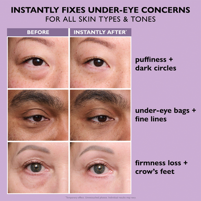🌸Final Day: 70% OFF🌸 Instant Eye Tightener – Lift, Smooth & Look 10 Years Younger Instantly ✨