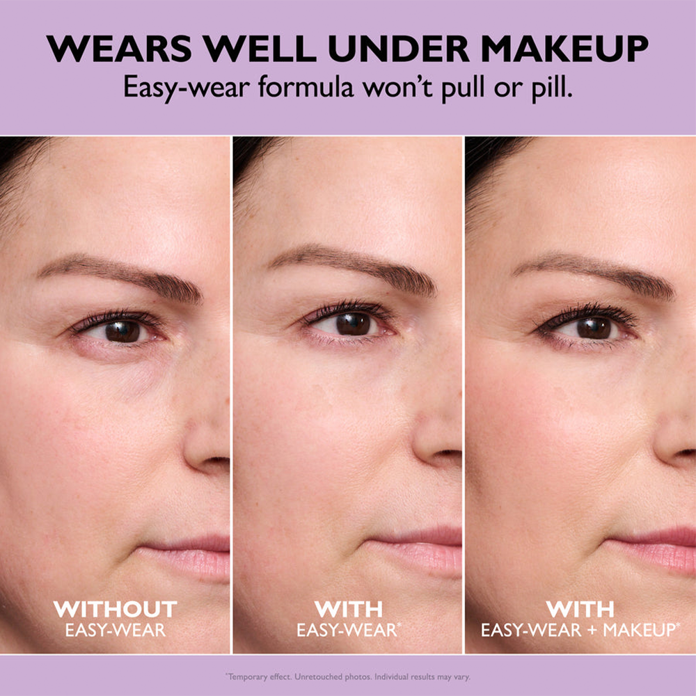 🌸Final Day: 70% OFF🌸 Instant Eye Tightener – Lift, Smooth & Look 10 Years Younger Instantly ✨