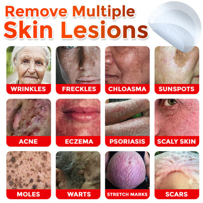 Negusy™ MicroNeedle Botanic Skin Tag Removal Patches – 🇺🇸 Made in the USA | Fast, Painless, Plant-Powered