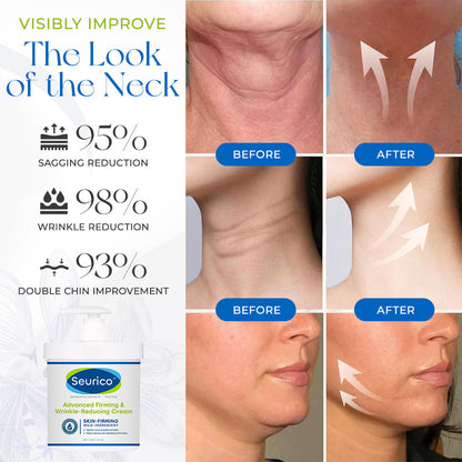 Seurico™ Advanced Firming & Wrinkle-Reducing Cream(Restore Skin Elasticity)