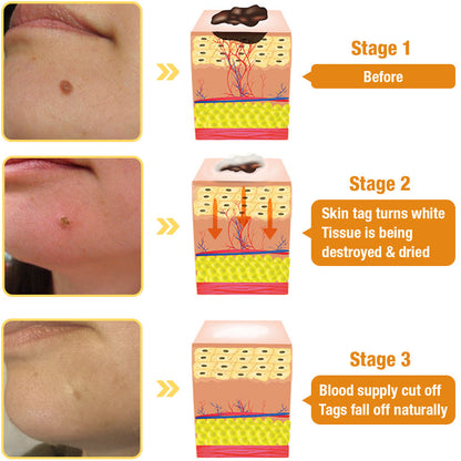 🐝NEGUSY™ TagRecede Bee Venom Treatment Spray