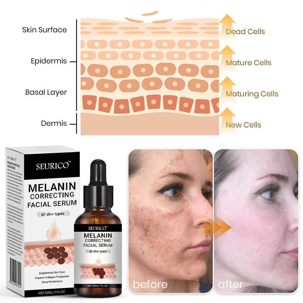 ✨Seurico™ Rapid Dark Spot Eraser – Melanin Correcting Facial Serum🔥