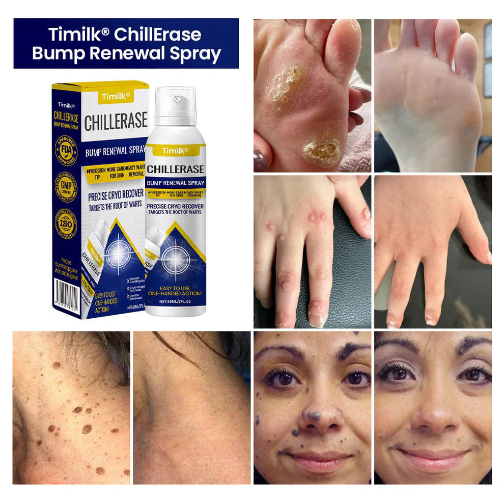 Timilk® ChillErase Bump Renewal Spray